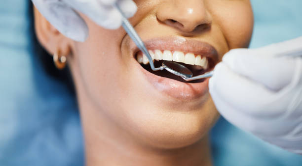 Best Cracked Tooth Emergency Dentist  in Rden, WA
